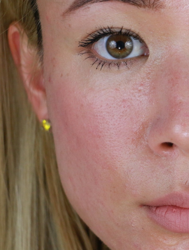 20170319160352_IMG_2261~2