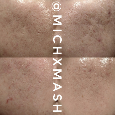 michxmash-before-afters-2