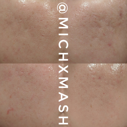 michxmash-before-afters